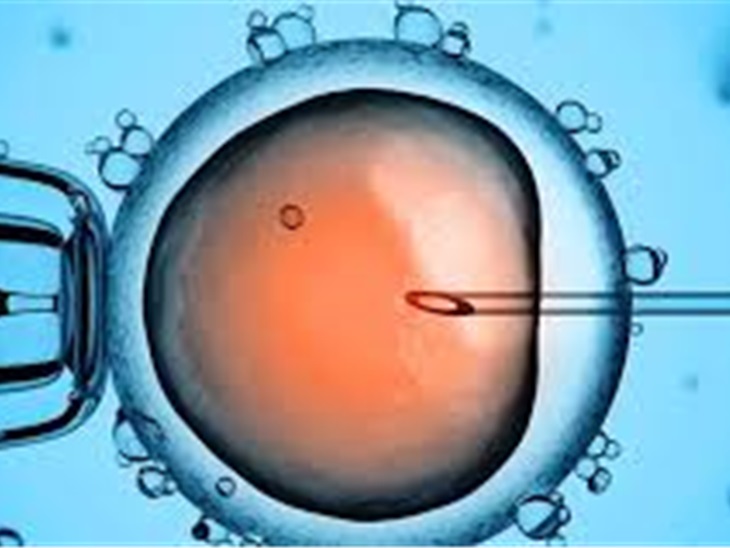 Servizio | ICSI (Intracitoplasmatic sperm injection)